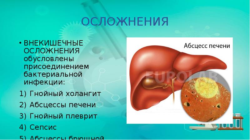 ОСЛОЖНЕНИЯ
ВНЕКИШЕЧНЫЕ ОСЛОЖНЕНИЯ обусловлены присоединением бактериальной инфекции:
Гнойный холангит
Абсцессы печени
ОСЛОЖНЕНИЯ
ВНЕКИШЕЧНЫЕ ОСЛОЖНЕНИЯ обусловлены присоединением бактериальной инфекции:
Гнойный холангит
Абсцессы печени