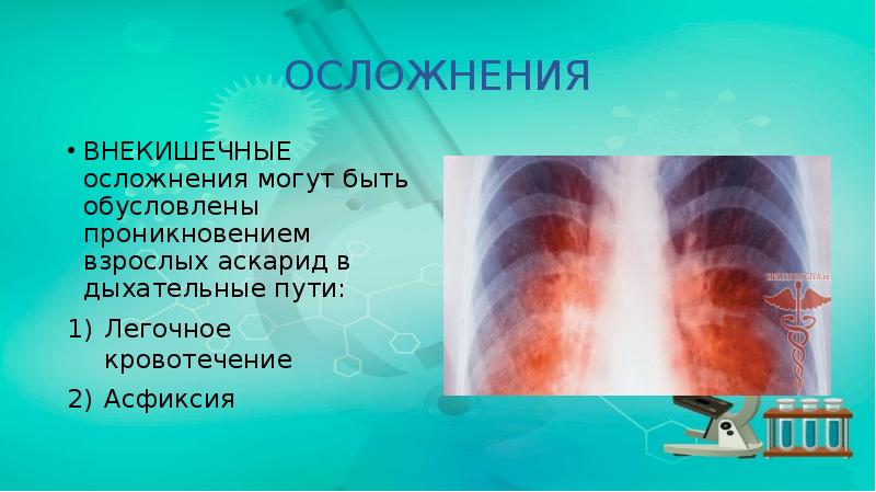 ОСЛОЖНЕНИЯ
ВНЕКИШЕЧНЫЕ осложнения могут быть обусловлены проникновением взрослых аскарид в дыхательные ОСЛОЖНЕНИЯ
ВНЕКИШЕЧНЫЕ осложнения могут быть обусловлены проникновением взрослых аскарид в дыхательные