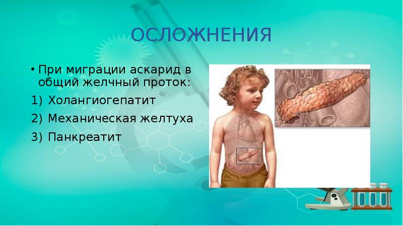 ОСЛОЖНЕНИЯ
При миграции аскарид в общий желчный проток:
Холангиогепатит
Механическая желтуха
ОСЛОЖНЕНИЯ
При миграции аскарид в общий желчный проток:
Холангиогепатит
Механическая желтуха