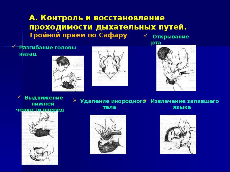 Нарушение проходимости. Восстановление проходимости дыхательных путей тройной прием. Методы восстановления проходимости дыхательных путей. Приемы восстановления проходимости дыхательных Сафара. Восстановление проходимости дыхательных путей алгоритм.