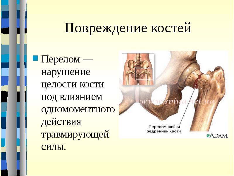 Презентация первая помощь при травмах опорно двигательной системы