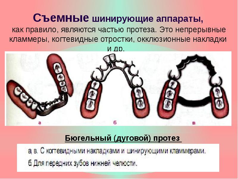 Шинирующие бюгельные протезы презентация