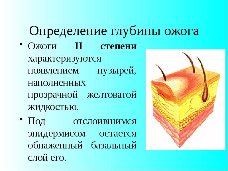 Презентация ожоги биология 8 класс