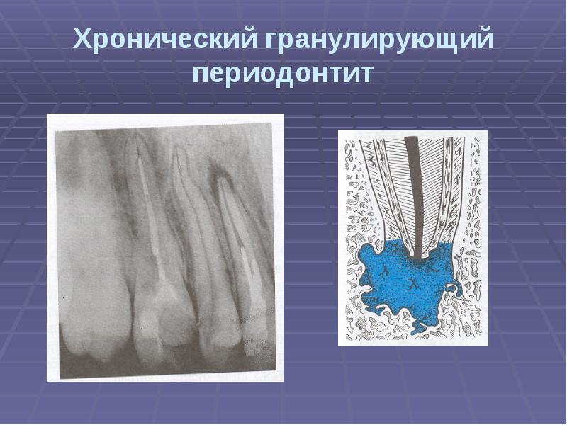 Пульпа зуба презентация