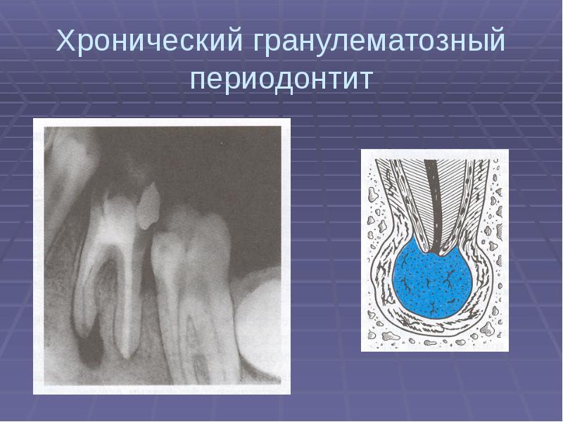 Пульпа зуба презентация