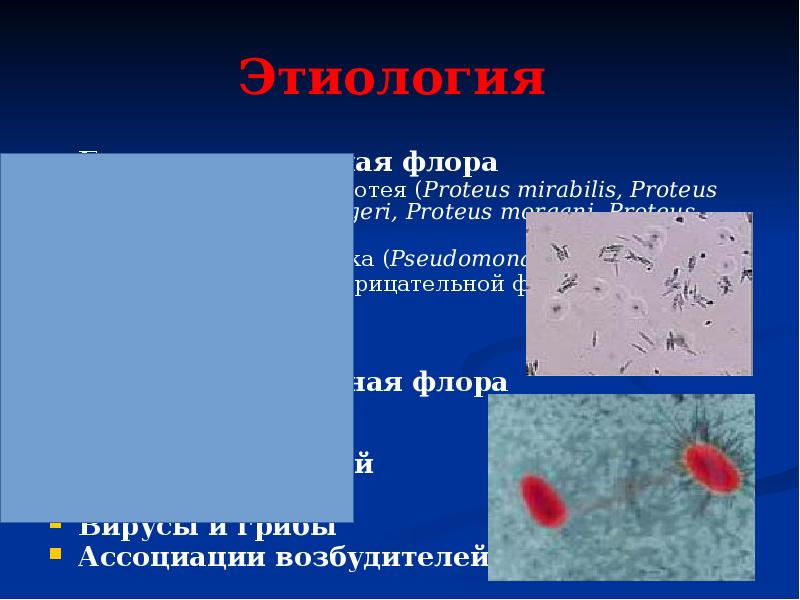 Пиелонефрит урология презентация