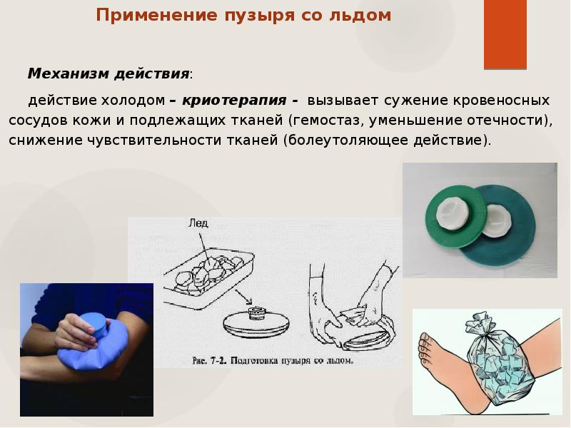 Пузырь со льдом показания. Показания для постановки пузыря со льдом. Постановка пузыря со льдом. Постановка пузыря со льдом оснащение.