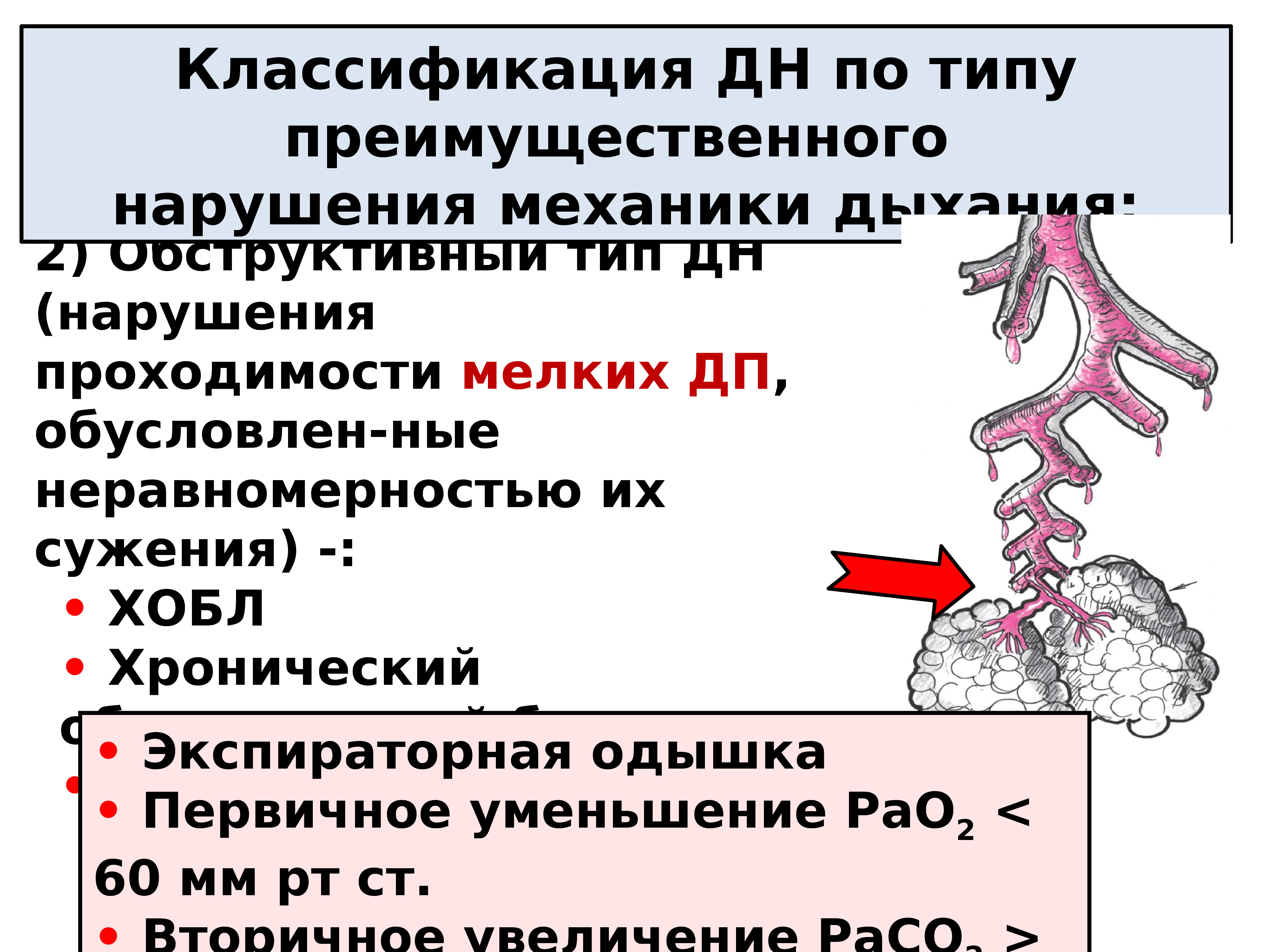 Обусловлено дыхательной недостаточностью. ЭКГ при дыхательной недостаточности. Обтурационная дыхательная недостаточность. Обструктивный Тип дыхательной недостаточности. Обструктивный Тип нарушения дыхания.