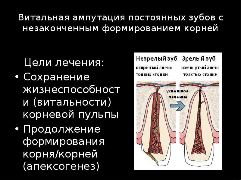 Формирование корешка