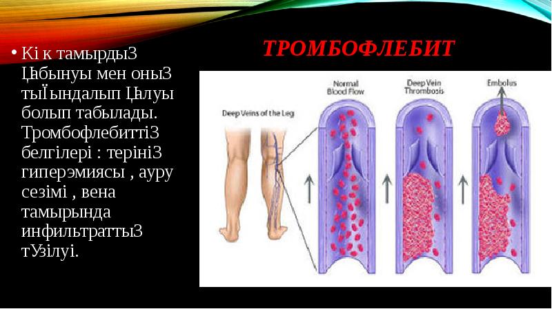 Көк жөтел презентация