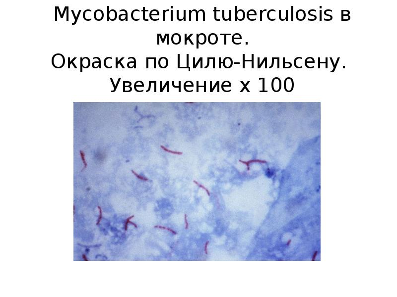 Микобактерии туберкулеза рисунок