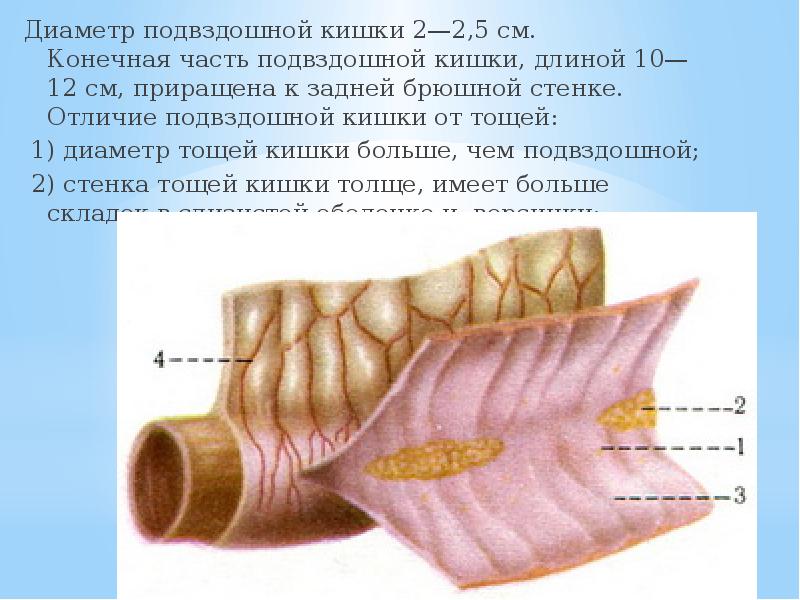 Терминальный отдел подвздошной кишки где находится схема