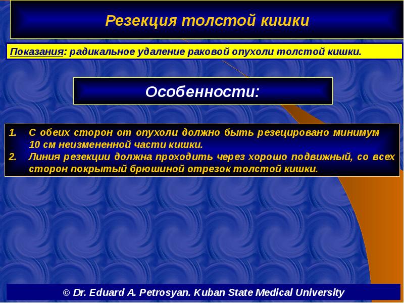 Особенности: