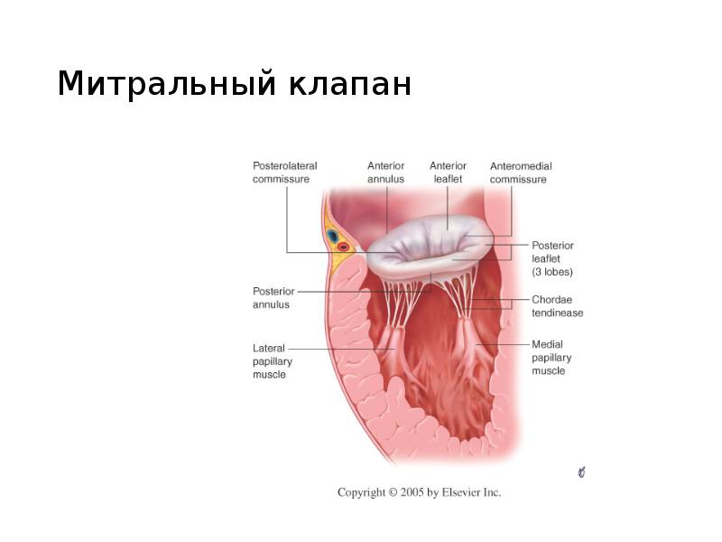 Замена митрального клапана сердца