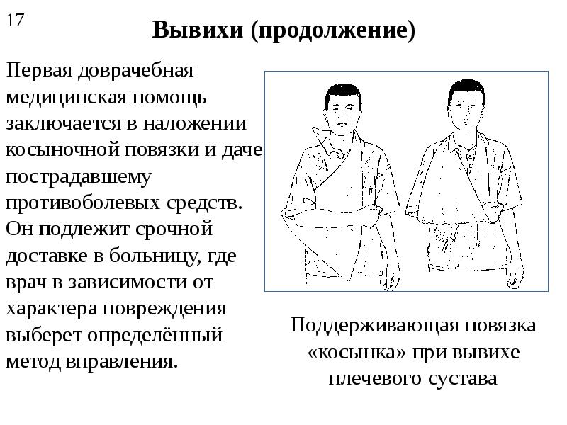 Используя приведенный перечень буквами обозначьте на схеме порядок медицинской помощи при вывихе