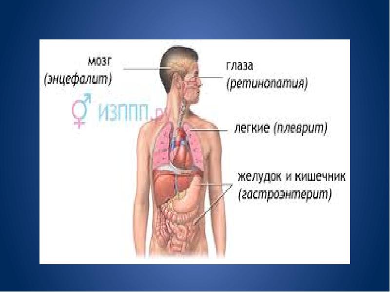 Клиническая картина цмв