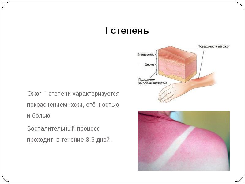 Фото ожог руки 1 степени