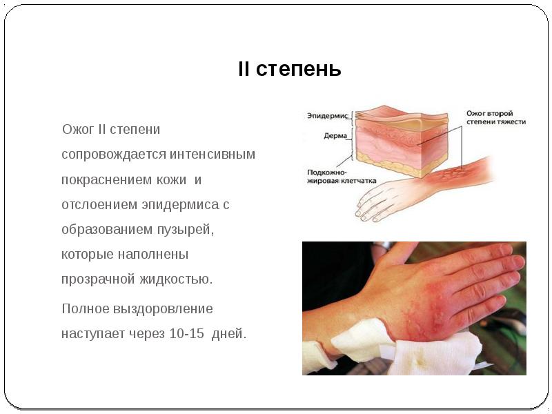 Термический ожог 2 степени карта вызова