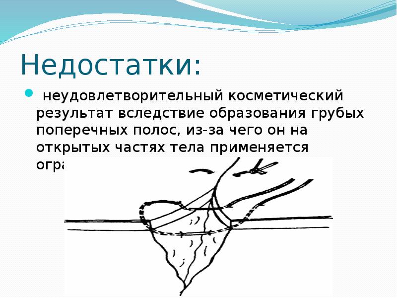 Открытые части. Отличие косметического шва от обычного. Лучшего косметического результата позволяет добиться шов.