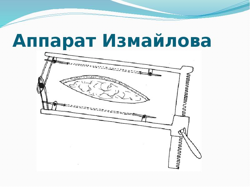Аппарат Измайлова