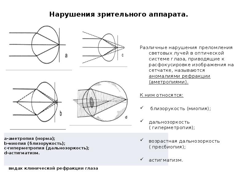 Приведенный глаз