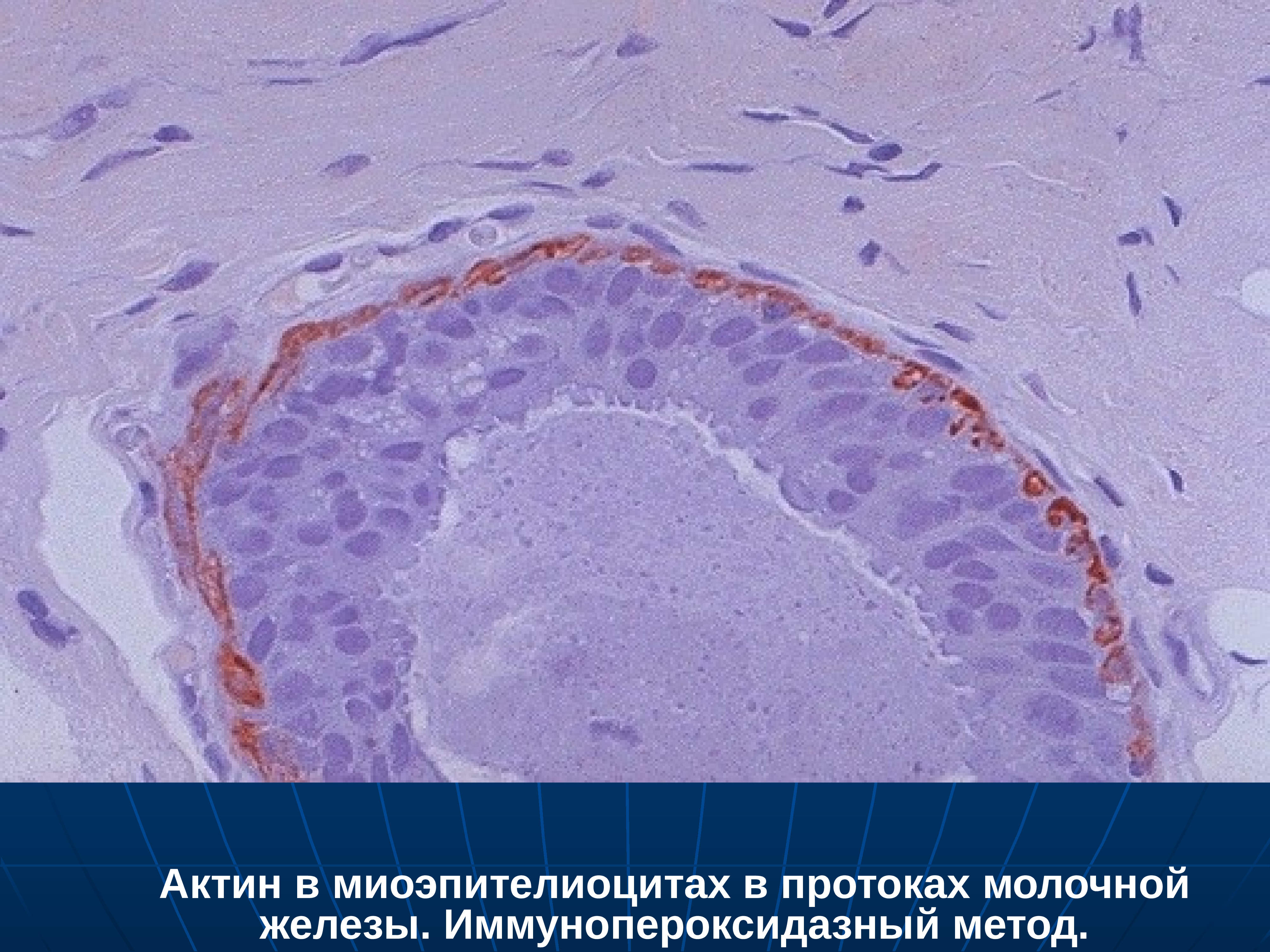 Краткая патологическая анатомия. Объекты патологической анатомии. Содержание патологической анатомии. Объекты и методы исследования в патологической анатомии.