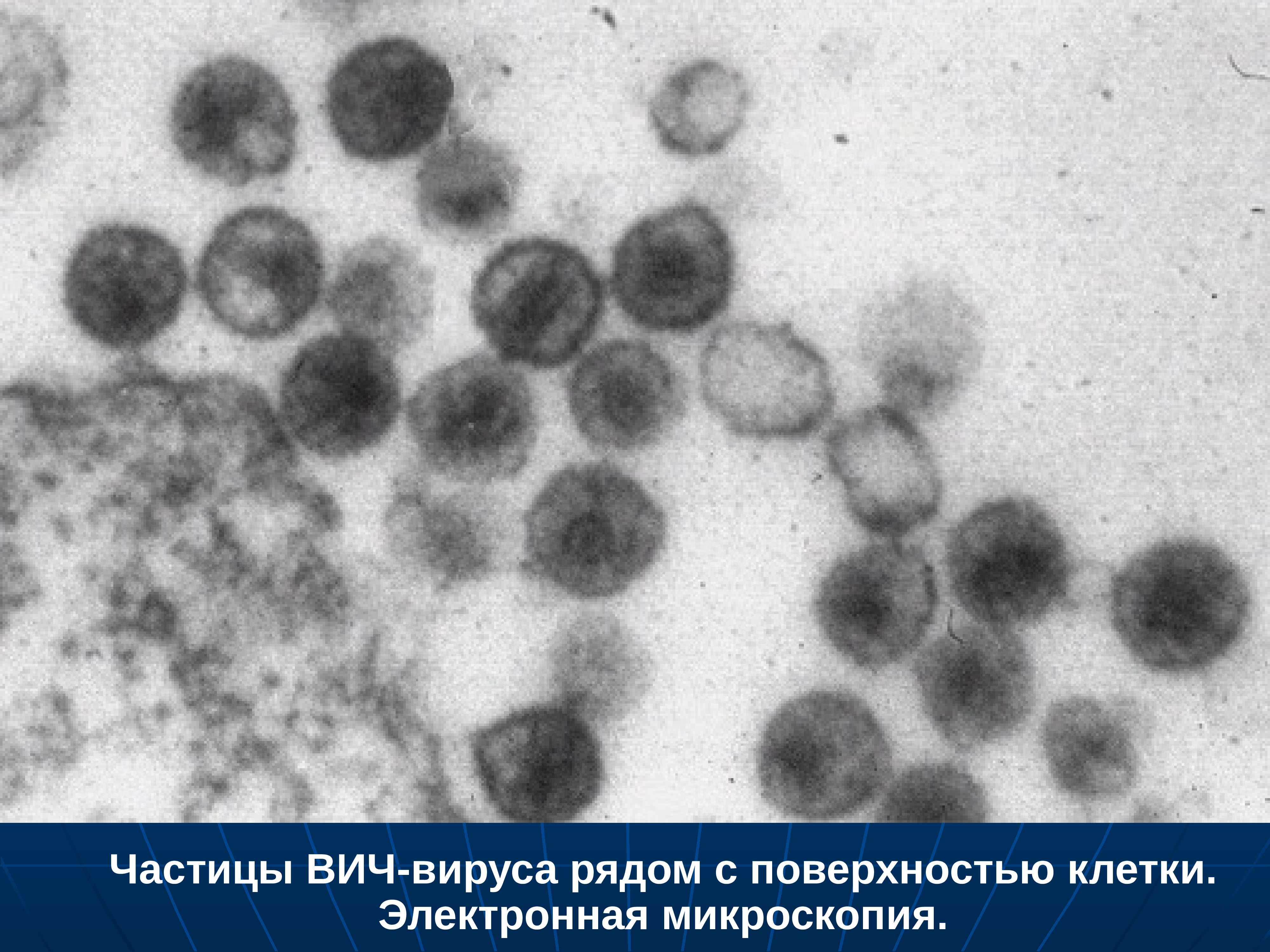Фото вич вируса под микроскопом