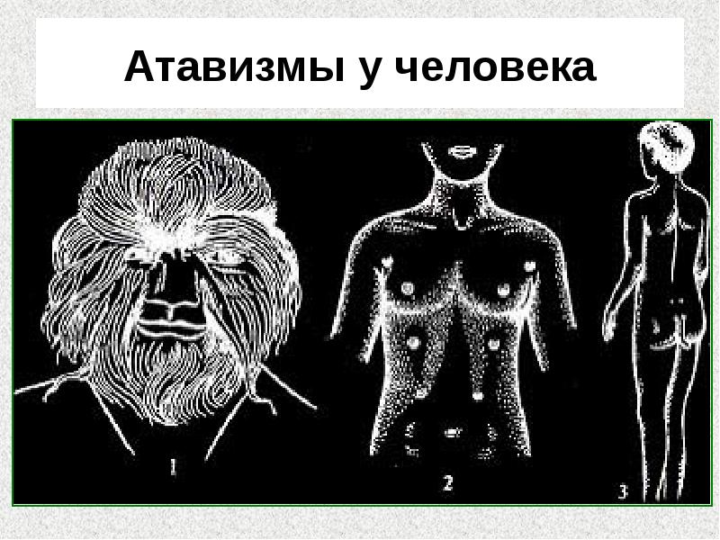 Атавизмы у человека Атавизмы у человека