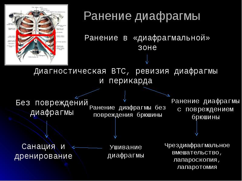 Повреждение грудной клетки презентация