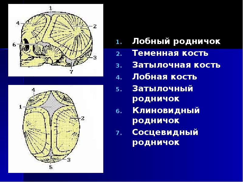 Большой родничок. Череп рентген анатомия. Рентгеноанатомия черепа. Рентгенанатомия Церема. Череп в боковой проекции анатомия.