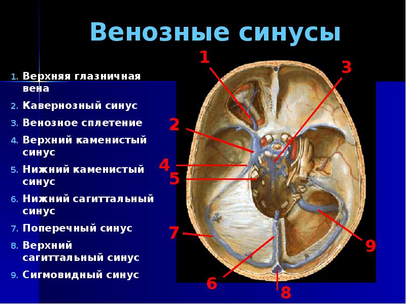 Синусы мозга схема