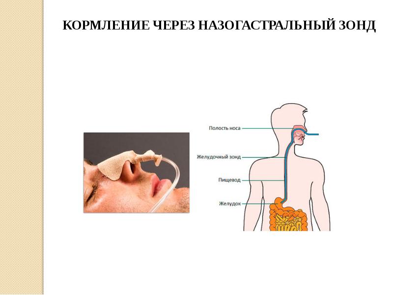 Зондовое питание картинки