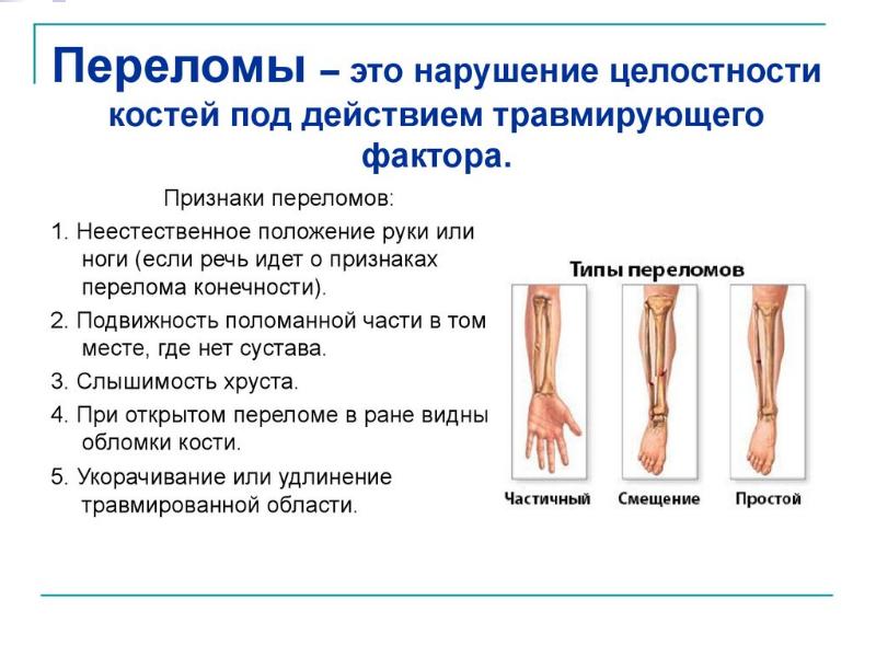 Переломы виды переломов первая помощь презентация