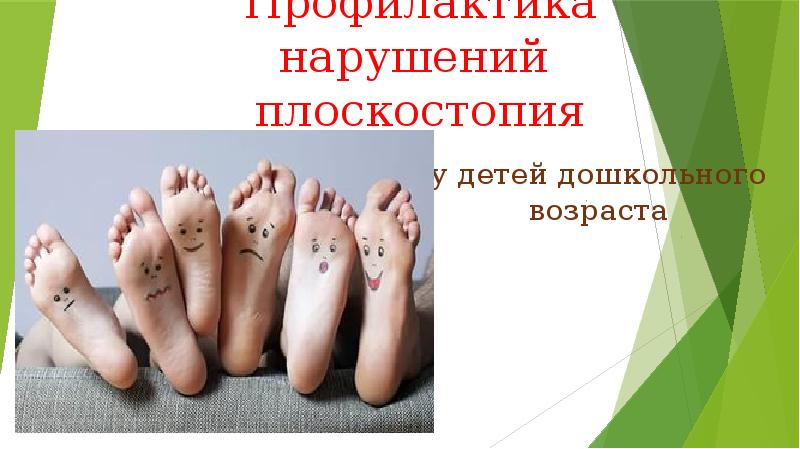 Презентация про плоскостопие