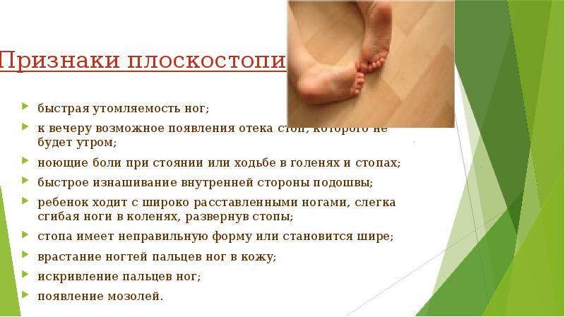 Проект про плоскостопие