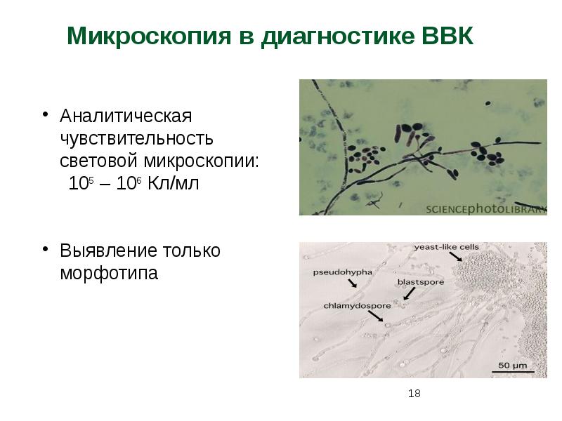 Оценка каких свойств микроорганизмов показана на рисунке