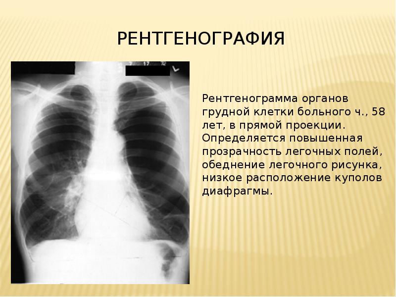 Лучевая диагностика органов дыхания презентация