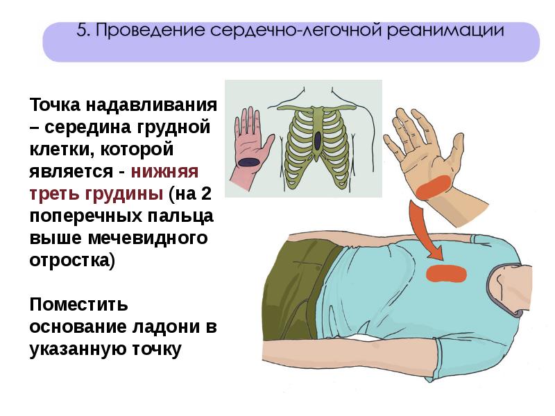 Первая помощь при острых нарушениях дыхания и во время остановки сердца презентация