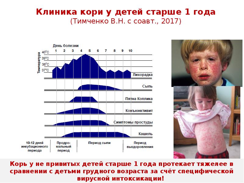 Корь в каком возрасте. Корь Возраст заболевания. Корь клинические рекомендации.