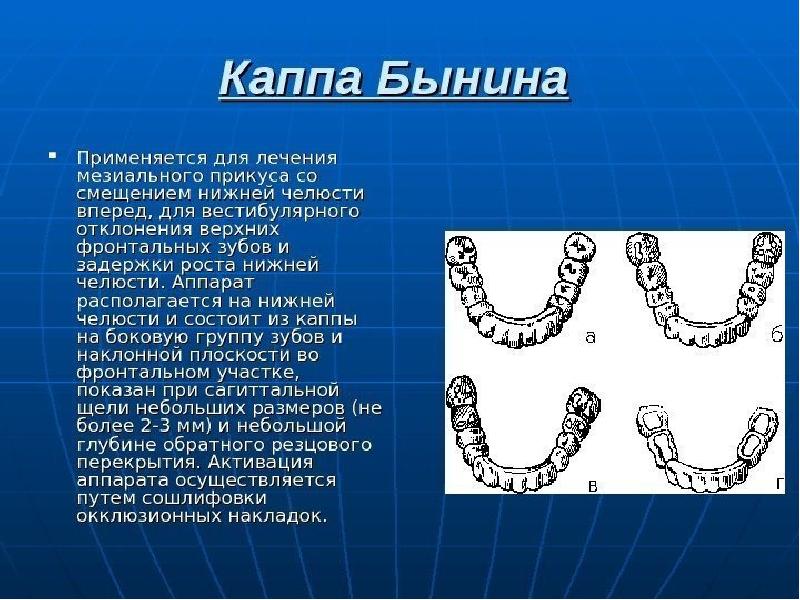 Мезиальная окклюзия презентация ортодонтия