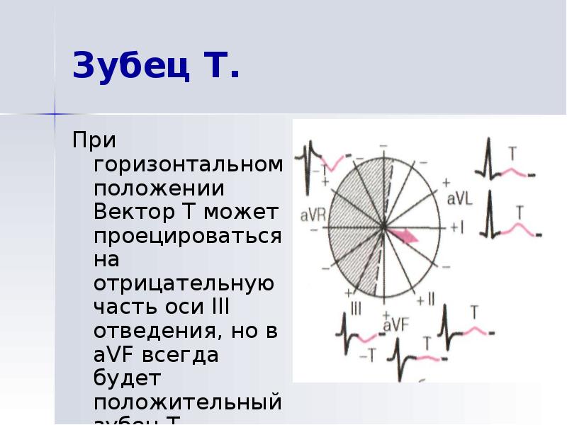 Горизонтальное положение оси