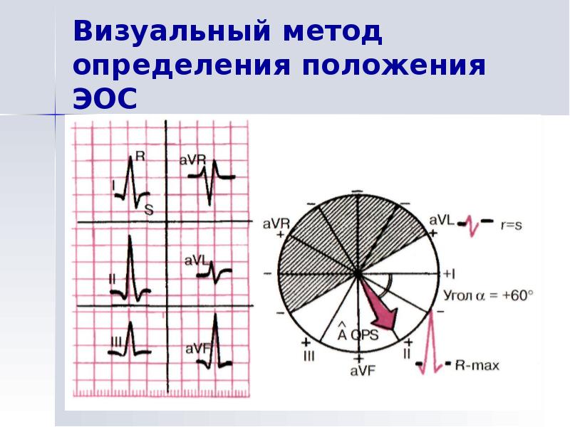 Эос просвет