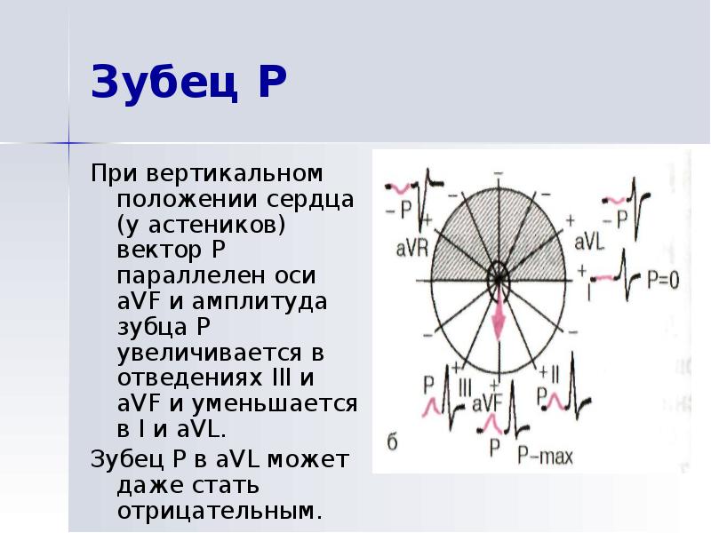 Вертикальное положение сердца