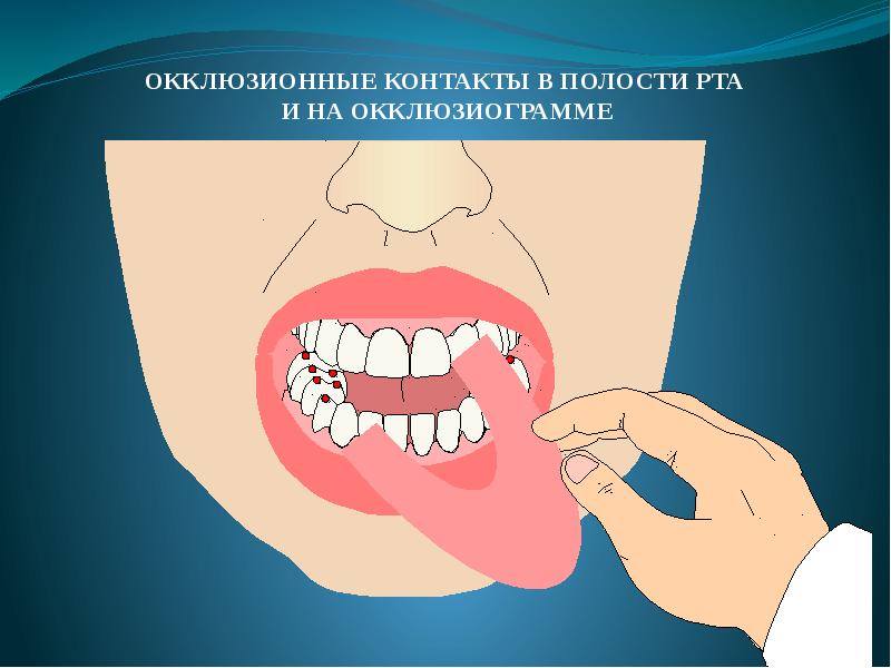 Основы окклюзионной диагностики презентация