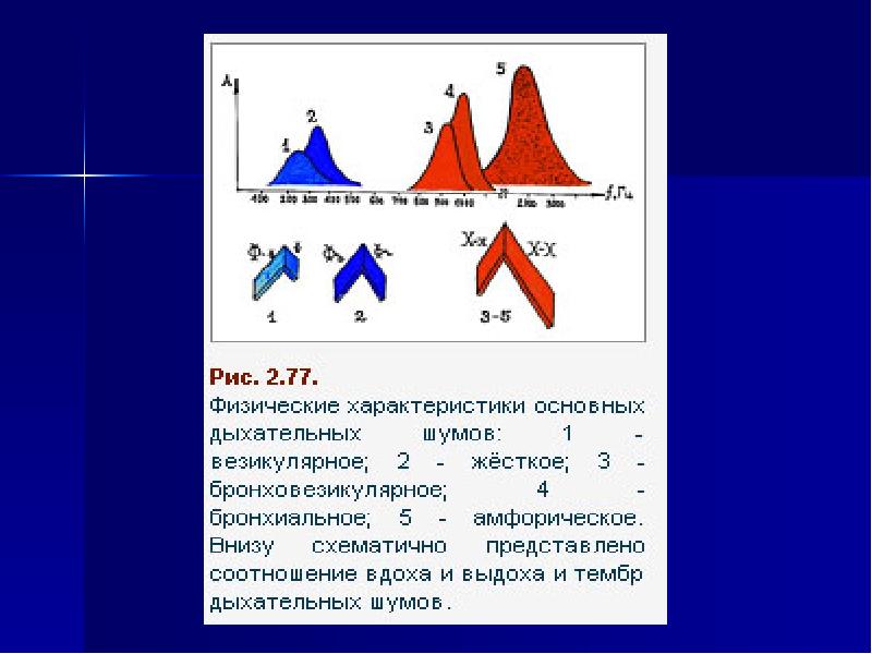 Схемы основных дыхательных шумов