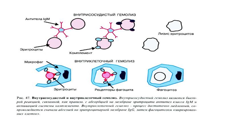 Гемолиз эритроцитов. Гемолиз эритроцитов схема. Механизм внутриклеточного гемолиза. Механизмы внутрисосудистого гемолиза эритроцитов. Механизм гемолиза эритроцитов схема.