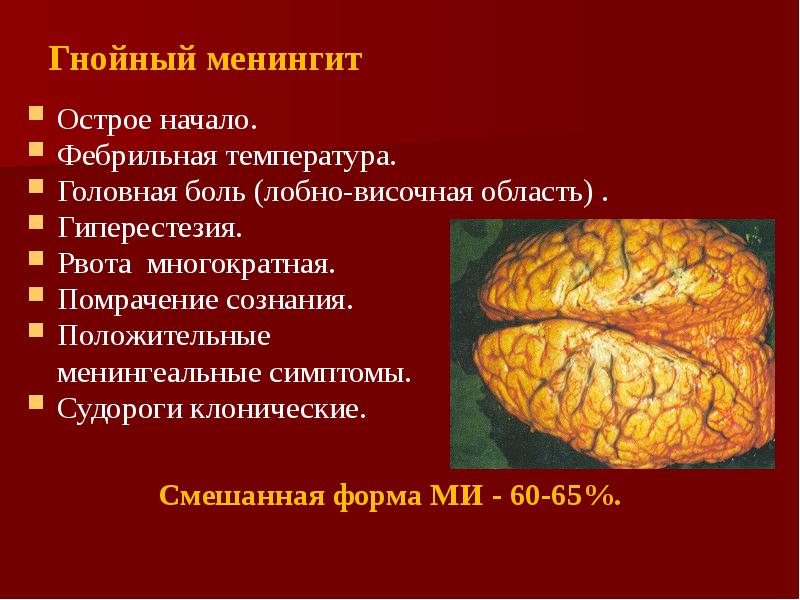 Менингит презентация казакша