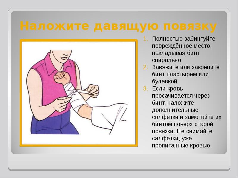 Первая помощь при наружном и внутреннем кровотечении урок обж 8 класс презентация