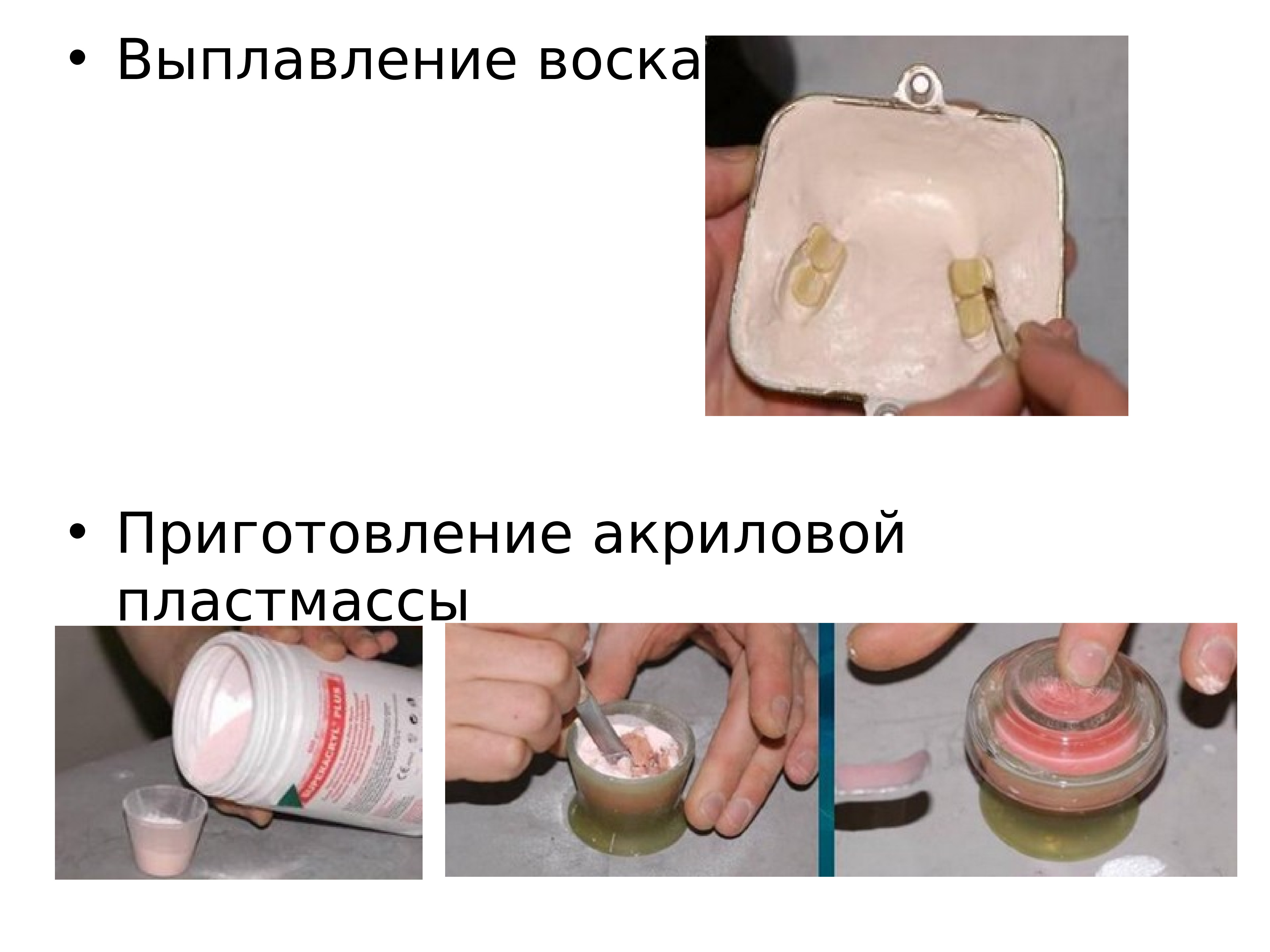 Формовочные материалы в ортопедической стоматологии презентация