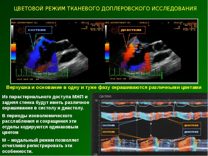 Эхокардиография с допплеровским анализом. Цветовое допплеровское исследование. Тканевое допплеровское исследование. Цветное допплеровское картирование матки. Цветное допплеровское картирование яичников.